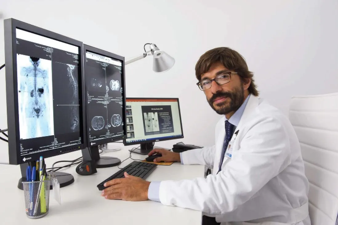Diagnosi precoce del cancro: come funziona la Diffusion Whole Body